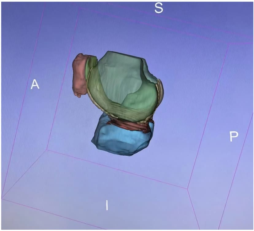 软骨预测精准度